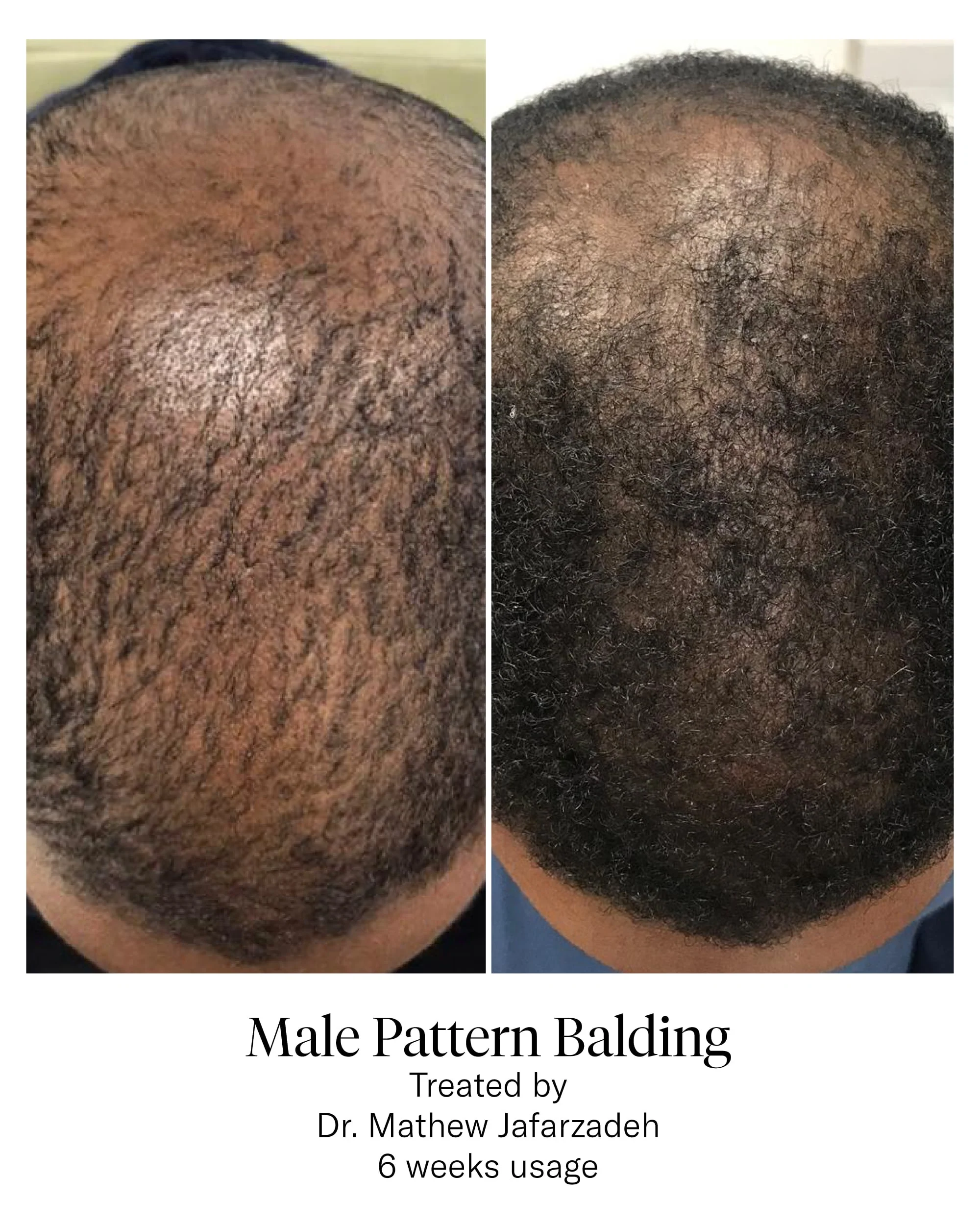 Hair Serum - Image 6